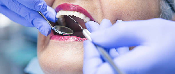 Best Emergency Dental Care for Broken or Chipped Teeth in Stanley, VA